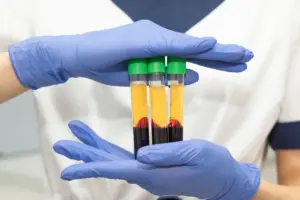 PRP treatment wakefield ma