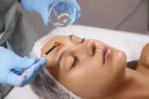 chemical peels wakefield ma