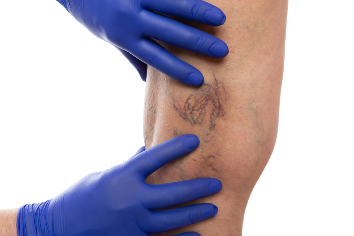 LED Photobiomodulation Therapy in Wakefield, MA